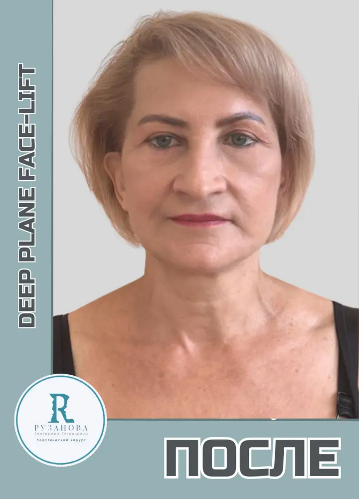 SMAS-результаты (11)