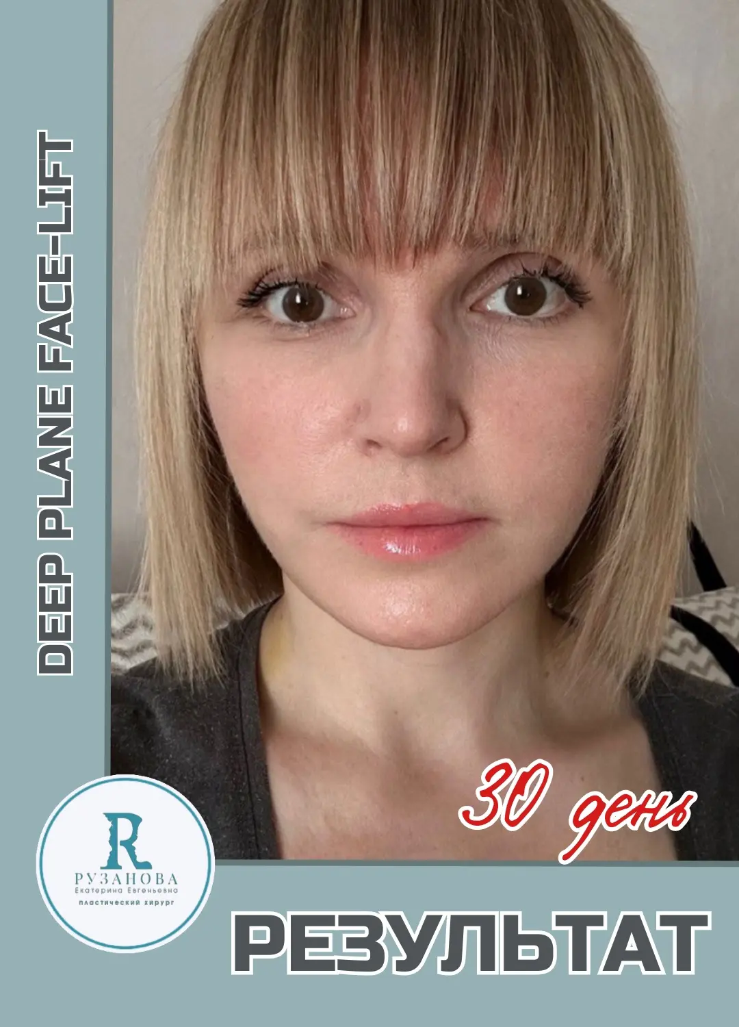 SMAS-результаты (6)